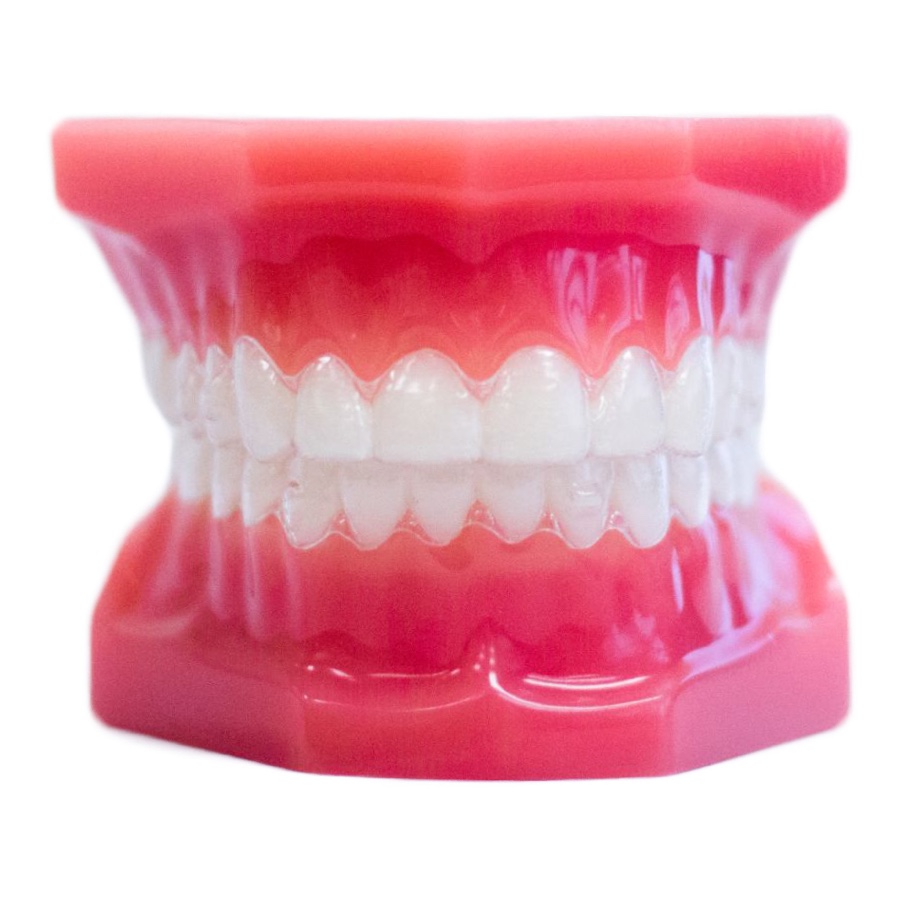 clear plastic orthodontic aligners plastic model